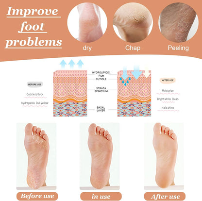 Calcetines de silicona hidratantes - additional image 3